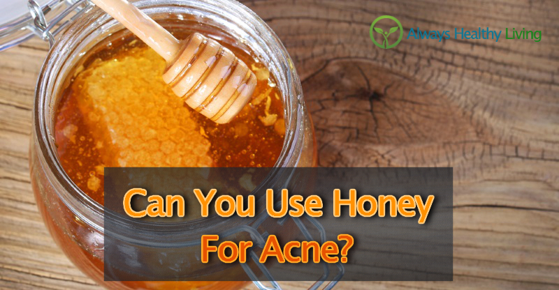 Can You Use Honey For Acne Treatment? - Always Healthy Living